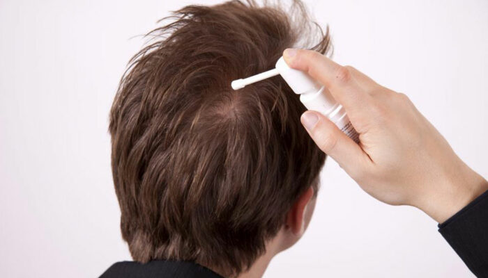 10 Products That Prevent Hair Loss