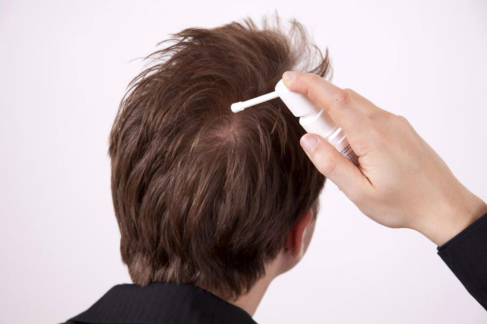 10 Products That Prevent Hair Loss